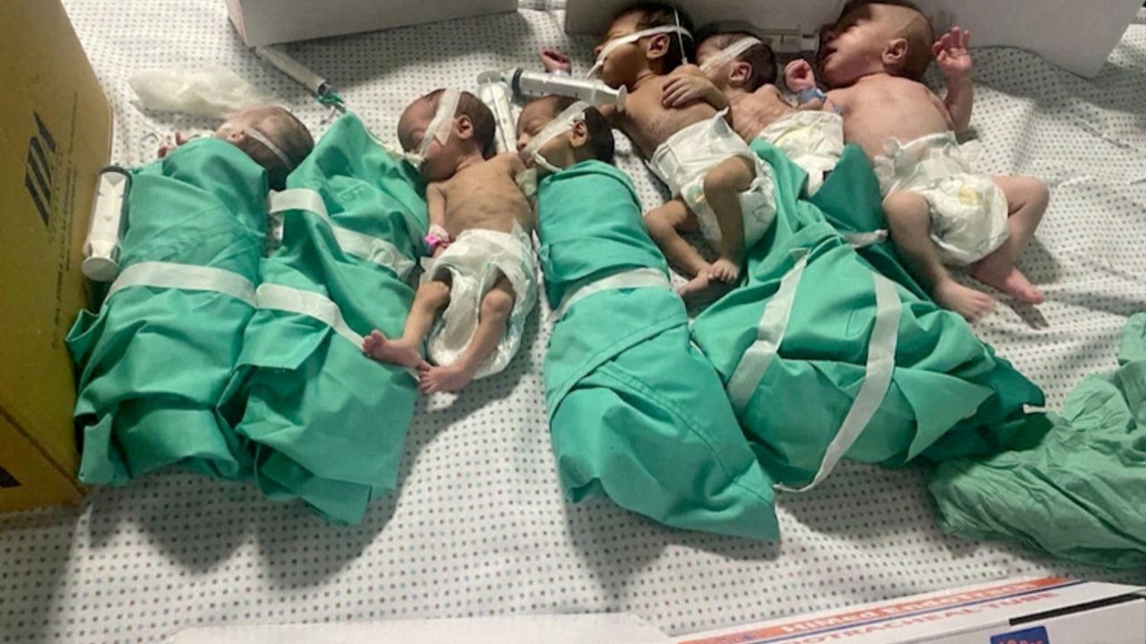 Şifa Hastanesi'nde bebekler kuvözden çıkarıldı