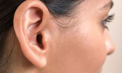 Kepçe kulak çocuklarda travma sebebi