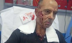 Bursa'da Kangal köpeğinin saldırı adama 100'den fazla dikiş atıldı