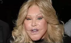 Kedi Kadın Jocelyn Wildenstein 84 yaşında hayatını kaybetti