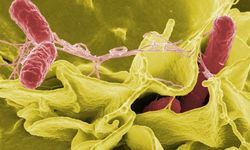 Salmonella enfeksiyonu dikkat edilmediğinde ölümcül olabilir