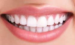 Gülüş Tasarımı ile Estetik Diş Hekimliğinde Yeni Bir Dönem Başlıyor