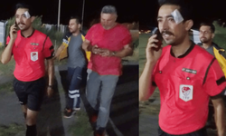 Hakem kırmızı kart gösterdi, futbolcu yumrukladı