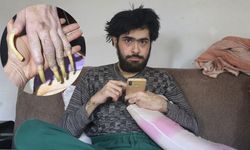 3 yıldır ne duş alıyor ne tırnaklarını kesiyor! İnanılmaz olayın nedeni yürek yaktı