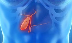 Safra kesesi hastalıklarında erken teşhis tedaviyi kolaylaştırıyor