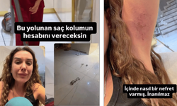 Dilan Polat ablası Sıla Doğu'dan dayak yedi! Görüntüleri paylaştı