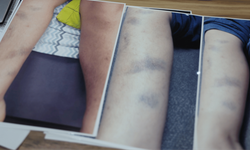 Diyarbakır'da 8 yaşındaki çocuğun darbedildiği iddiası