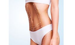 Vücut Kontüründe Yeni Bir Sayfa: Karın Germe Ameliyatı İle Estetik Bir Dönüşüm