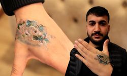 Dövme sildirmek isterken hayatı kabusa döndü! "Ağrın varsa eczaneden ağrı kesici al"