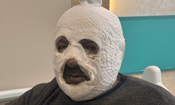 Erzincan'da faciadan dönüldü: Alevler yüzünü sardı