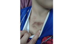 İBB kreşinde istismar ve darp iddiası