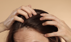 Kadınlarda saç dökülmesinin gizli nedenleri