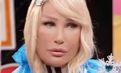 Seda Sayan’ın yüzündeki şişliğin nedeni belli oldu