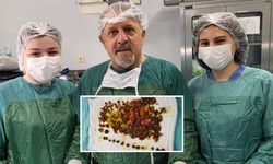 Karın ağrısıyla gitti! Safra kesesinden çıkanlar doktorları bile şaşırttı...