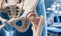 Avasküler Nekroz Ameliyatı: Belirtiler, Tedavi Süreci ve Ameliyat Sonrası