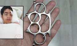 İstanbul’da akran zorbalığı dehşeti! 15 yaşındaki çocuğu muştayla öldüresiye dövüldüler