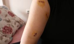30 yerinden bıçaklayan eski koca tehditlerine devam ediyor: Yarım kalan işimi tamamlayacağım
