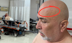 CHP'li Kaş Belediyesi makam odasında iş insanı darp edildi