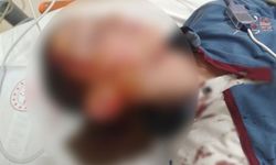 Köpek saldırısına 1.2 milyon TL tazminat!
