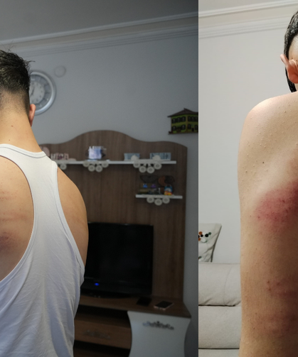 Niğde'de 15 yaşındaki berber çırağına darp iddiası: Önce dövdü, sonra temizlik yaptırdı