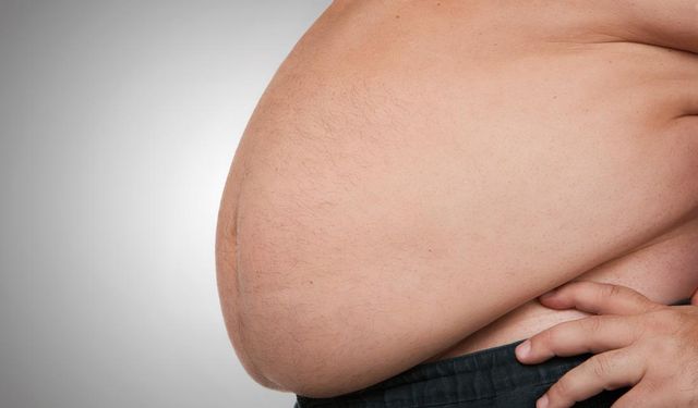 2035 yılına kadar 4 milyardan fazla kişinin obez olması öngörülüyor