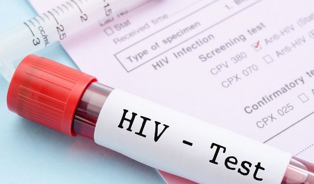 Erkek sünneti, HIV enfeksiyonuna karşı koruyor