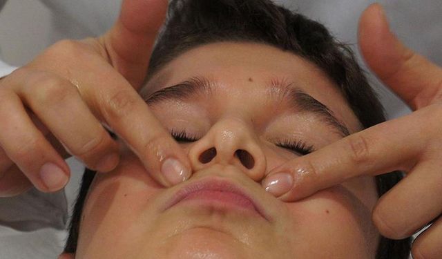 Uzmanı uyardı: "Yüz felcinde erken müdahale kalıcı hasarı önlüyor"