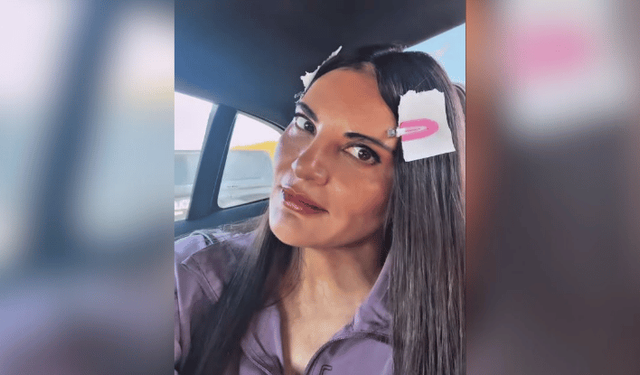 Göksel’den estetik iddialarına cevap: “Tanımıyorum”