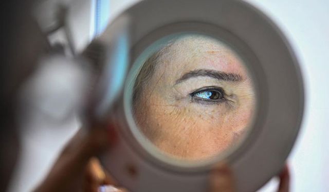 Bilim insanları yaygın bir kanser türünün viral nedenini keşfetti