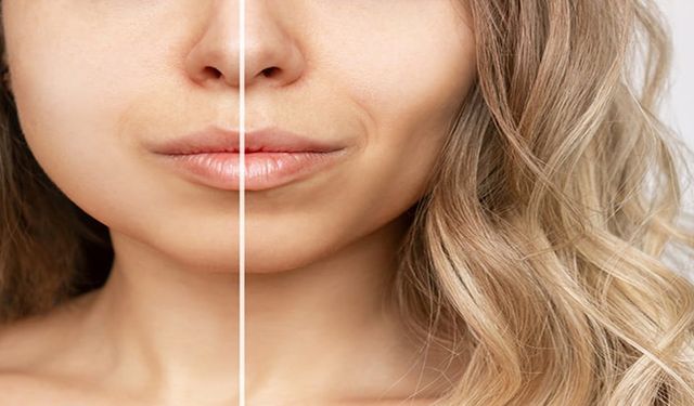 Doğal Görünümlü Bişektomi Mümkün mü? Abartıdan Kaçınmanın Yolları