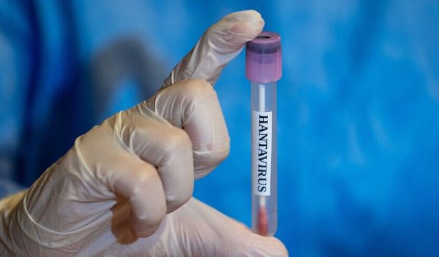 Sağlık Bakanlığı açıkladı: Türk yolcuların Hantavirüs test sonuçları belli oldu