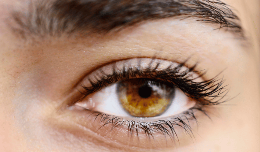 Sürekli gözünüz kaşınıyorsa dikkat: Kirpik dibi paraziti olabilir