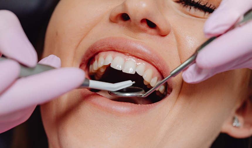 "Kanal tedavisindeki gecikme kistlere sebep olabilir"