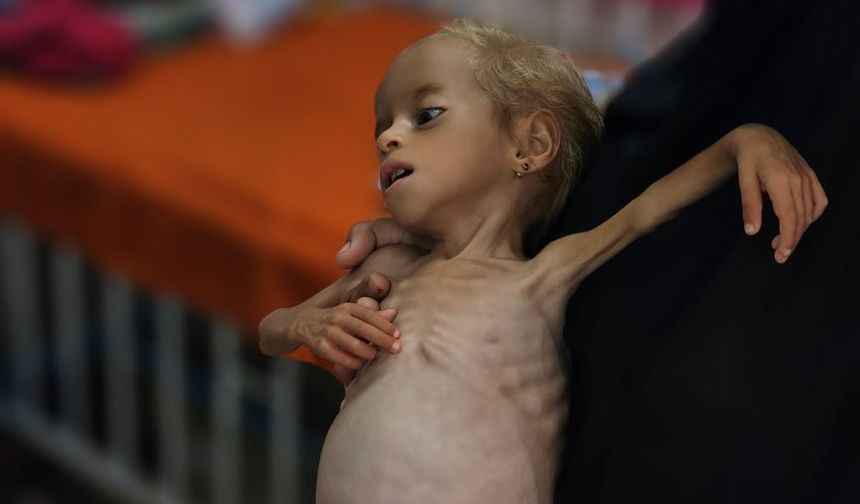 Gazze’de son 24 saatte 9 sivil açlık nedeniyle hayatını kaybetti