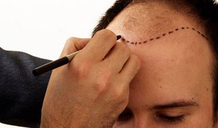 En İyi 10 Saç Ekimi Kliniği (2026): Klinik Seçimi İçin Kurumsal Rehber ve Öneri Listesi