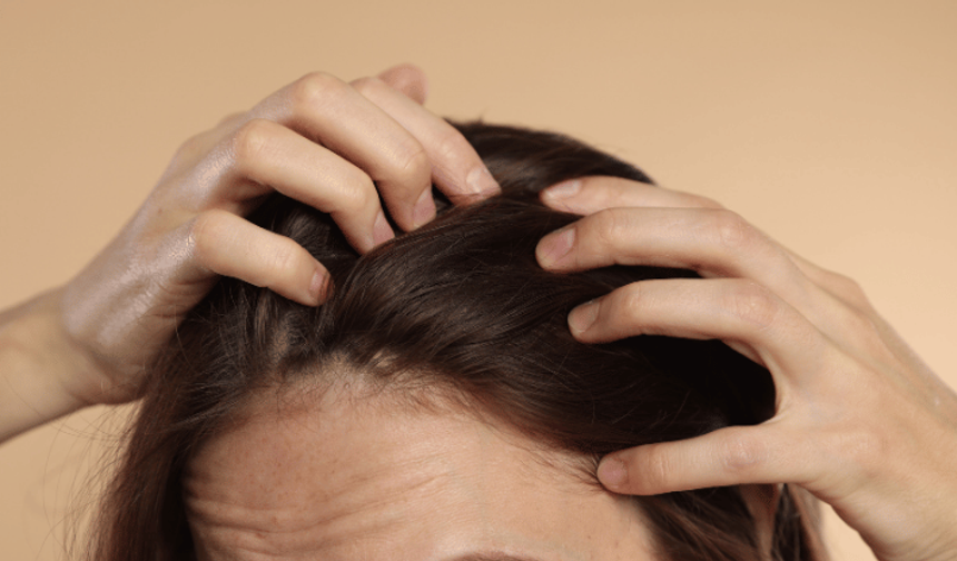 Kadınlarda saç dökülmesinin gizli nedenleri