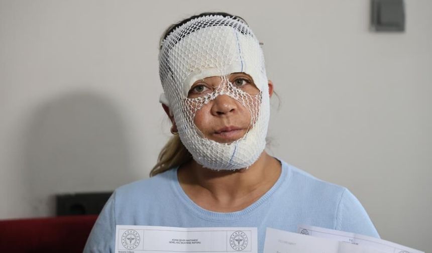 “Prenses bakımı” kabusa döndü! Yüzünde 2. derece yanıklar oluştu