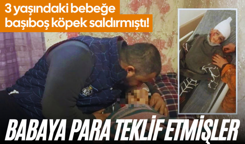 Başıboş köpek saldırmıştı! 3 yaşındaki bebek 34 gün sonra evinde... Babaya para teklif etmişler
