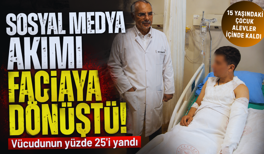 Sosyal medya akımı faciaya dönüştü! 15 yaşındaki çocuk alevler içinde kaldı, vücudunun yüzde 25'i yandı