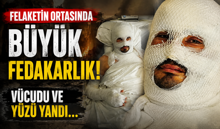 Felaketin ortasında büyük fedakarlık! Vücudu ve yüzü yandı...
