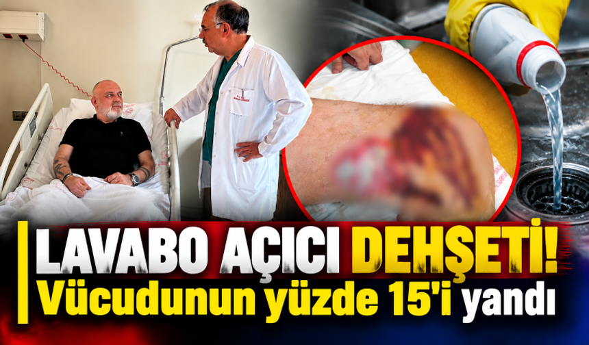 Lavabo açıcı dehşeti! Vücudunun yüzde 15'i yandı