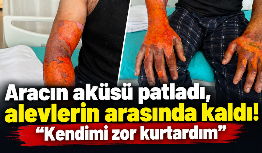 Aracın aküsü patladı, alevlerin arasında kaldı! “Kendimi zor kurtardım”
