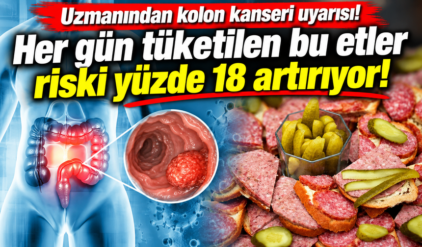 Uzmanından kolon kanseri uyarısı! Her gün tüketilen bu etler riski yüzde 18 artırıyor