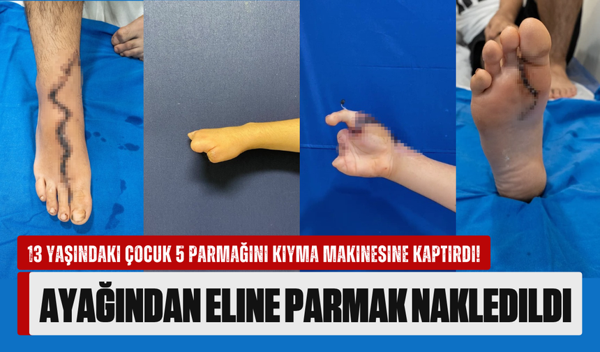 13 yaşındaki çocuk 5 parmağını kıyma makinesine kaptırdı! Ayağından eline parmak nakledildi