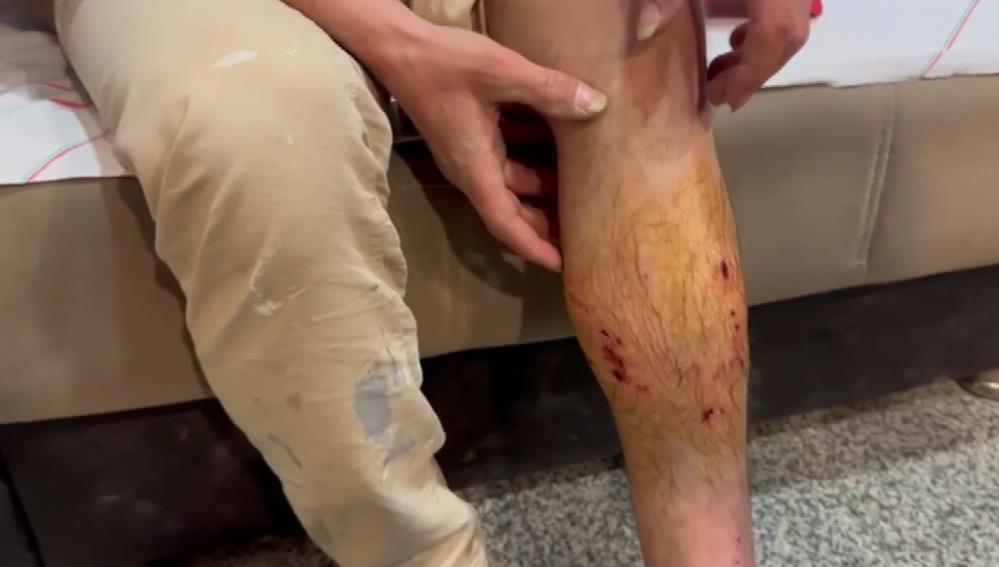 Adıyaman'da Yolda Yürüyen Kişiye Köpek Saldırdı1