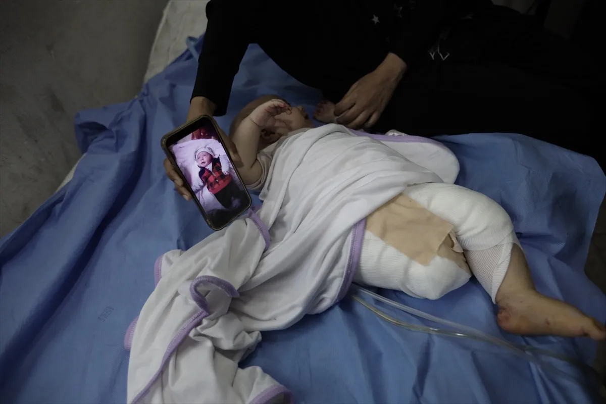 İsrail'in Saldırısında Vurulan 4 Aylık Bebek Bacağını Kaybetti