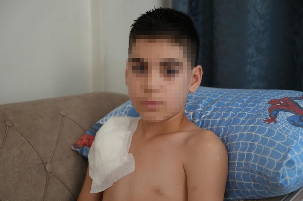 Samsun’da Sokak Köpeği 11 Yaşındaki Çocuğa Dehşeti Yaşattı