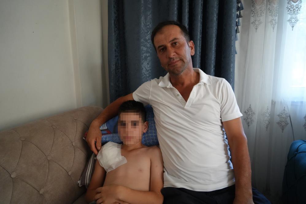 Samsun’da Sokak Köpeği 11 Yaşındaki Çocuğa Dehşeti Yaşattı2