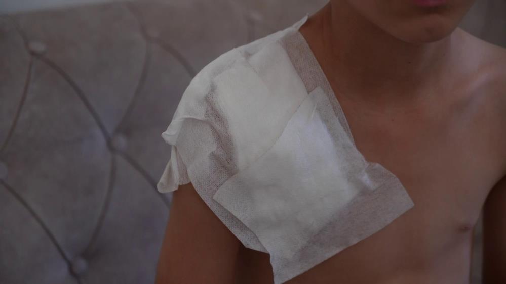 Samsun’da Sokak Köpeği 11 Yaşındaki Çocuğa Dehşeti Yaşattı3