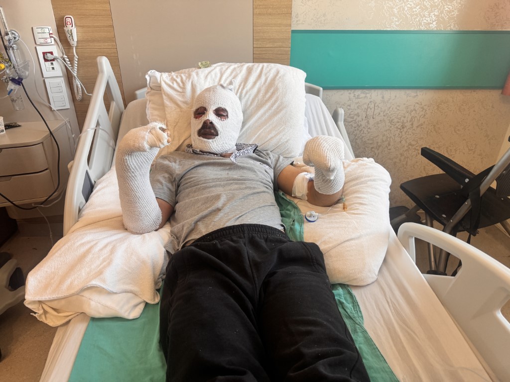 Çay Demlerken Hayatının Kabusunu Yaşadı (1)